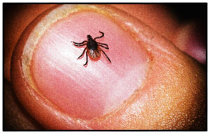 CBD Oil Can Help in the Treatment of Lyme Disease