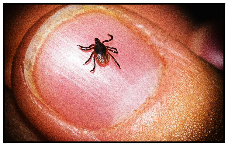 CBD Oil and the Treatment of Lyme Disease