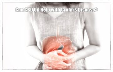Can CBD Oil Help with Crohn’s Disease?