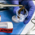 How To Pass A Hair Follicle Drug Test: Step By Step Guide 2023